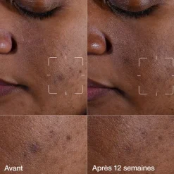 Even Better Clinical™