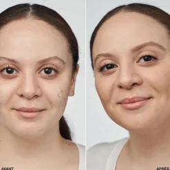 Even Better Clinical