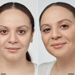 Even Better Clinical