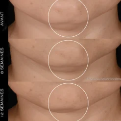 Rénergie H.P.N. 300-Peptide