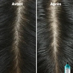 Scalp Advanced