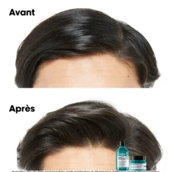 Scalp Advanced