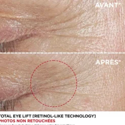 Total Eye Lift